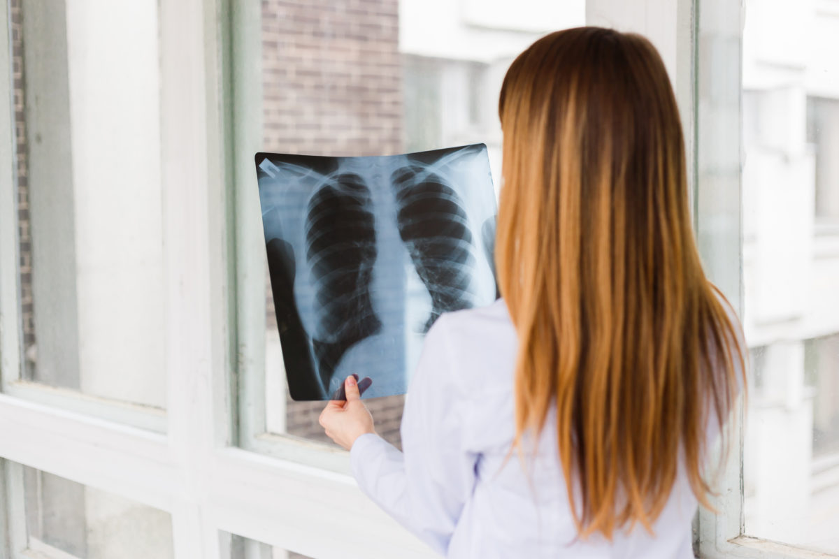 a-female-doctor-examines-an-x-ray-of-shot-of-the-PFJCCDB-1200x800.jpg