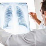 Lung Carcinoid Tumors