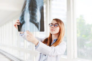young female doctor looking at the x ray picture 6MGQ3JL